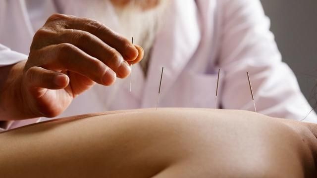 Acupuncture & Massage College